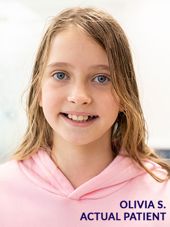 early orthodontic treatment